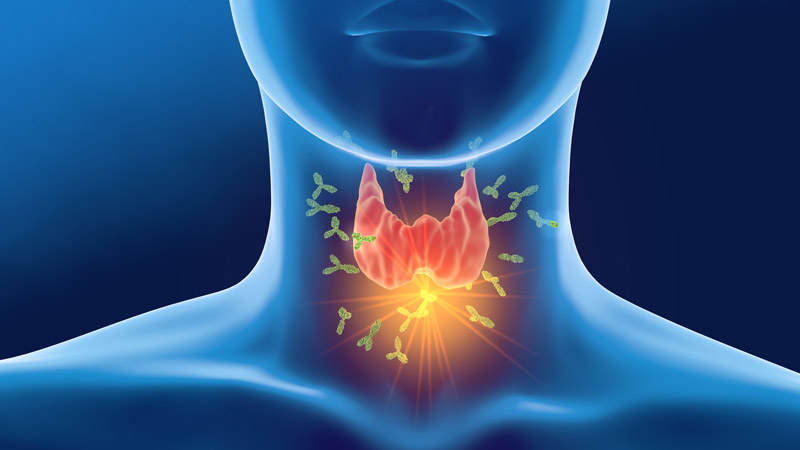 Anatomy of Thyroid with Hashimoto's Thyroiditis