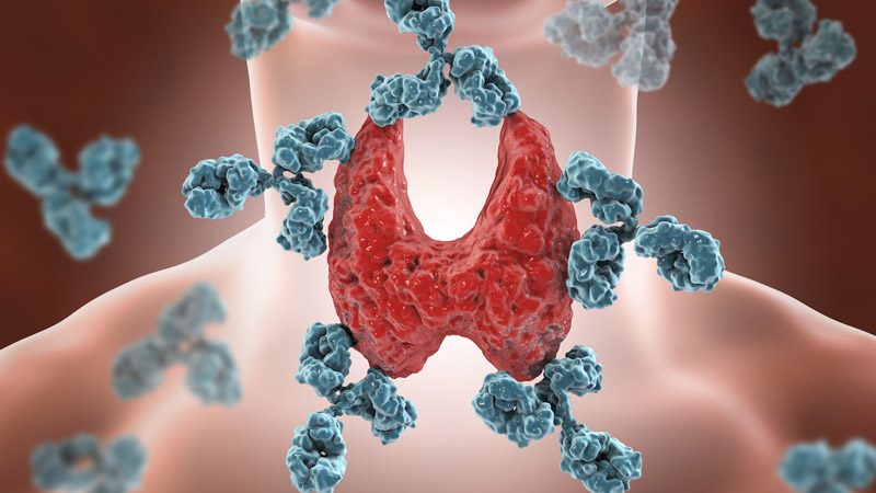 Antibodies Attacking Thyroid Gland