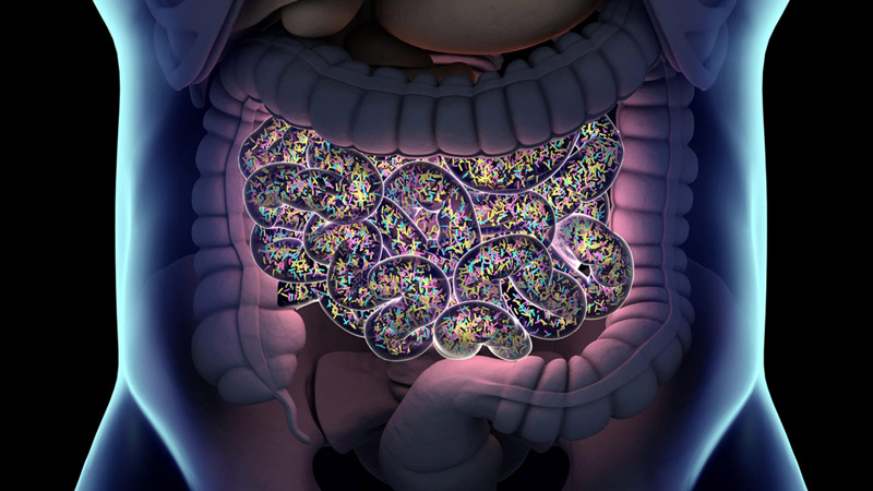 Small Intestinal Bacterial Overgrowth